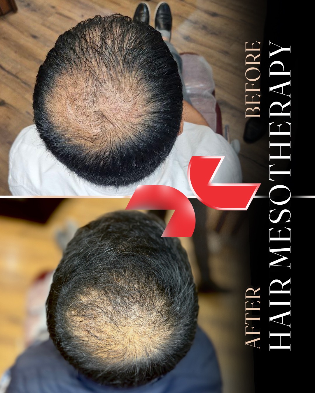 پیش‌نمایش پیکرتراشی